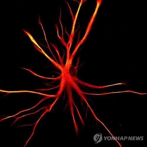 日서 척수손상 환자에 유도만능줄기세포 이식…"4명중 2명 개선"